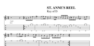 St. Anne's Reel - Image 2